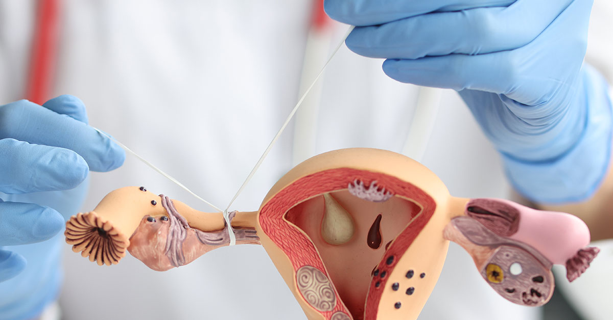 Laqueadura: do pedido até a cirurgia, entenda o processo em seis